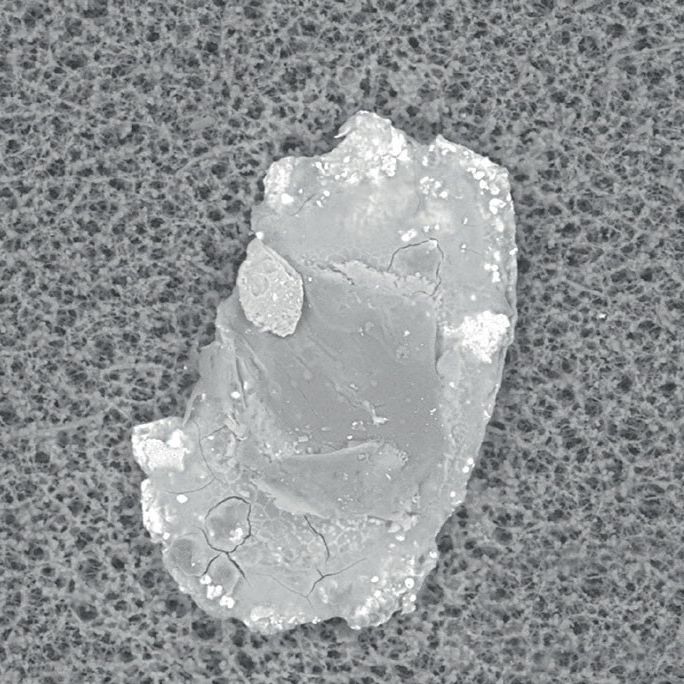 同一金属颗粒的电子显微图像